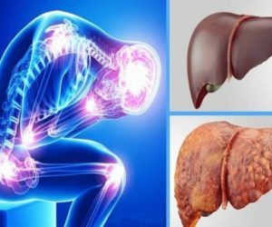 چه مواد غذایی برای کبد چرب مناسب است؟