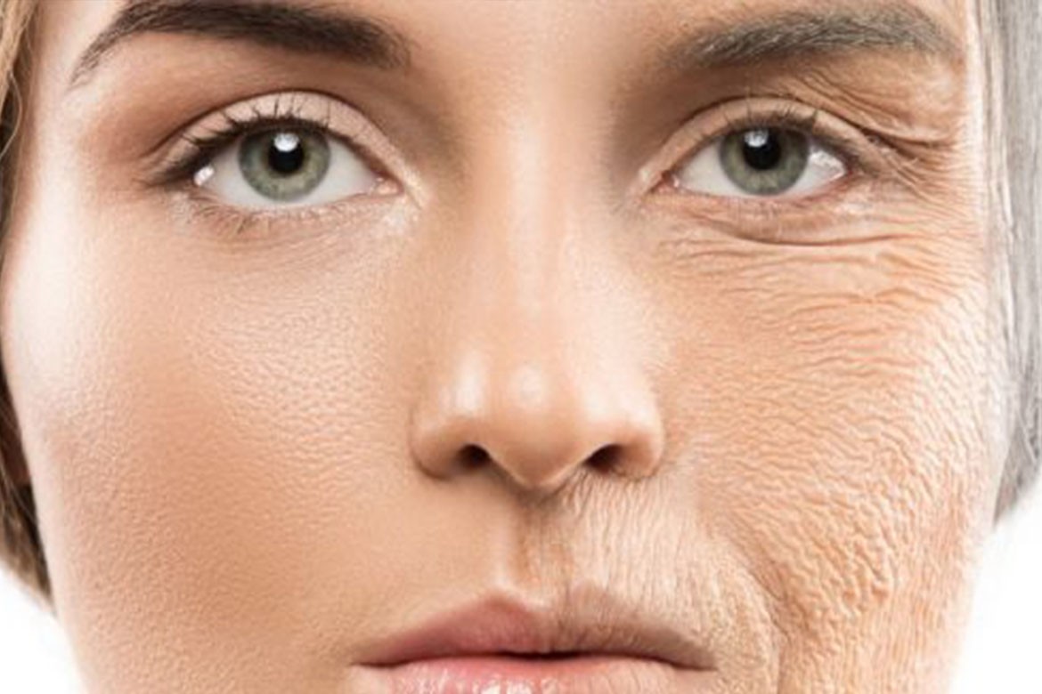 راه کار&zwnj;های جلوگیری از افتادگی پوست