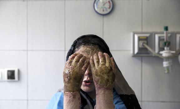 ناگفته‌های  قربانیان اسیدپاشی  هولناک در ایستگاه اتوبوس/ از فاجعه ترمینال کرمانشاه تا طلبه‌ای که خانه‌نشین شد
