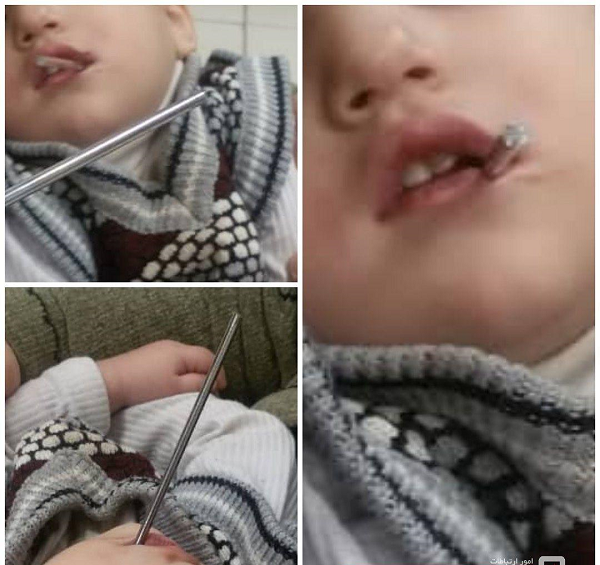 حادثه&zwnj;ای که کودک ۲ ساله مرندی از آن جان سالم به در برد