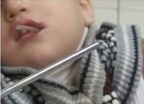 حادثه‌ وحشتناکی که کودک ۲ ساله از آن جان سالم به در برد + عکس