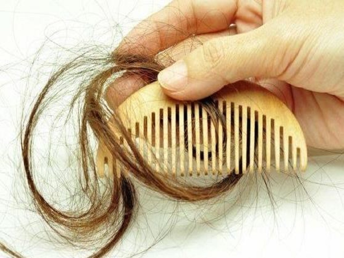 چگونه ریزش مو ایجاد می‌شود؟