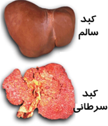 قاسمی امروز/ نتایج مثبت داروی ضدسرطان کبد حاوی نانوذرات پلی&zwnj;پپتیدی