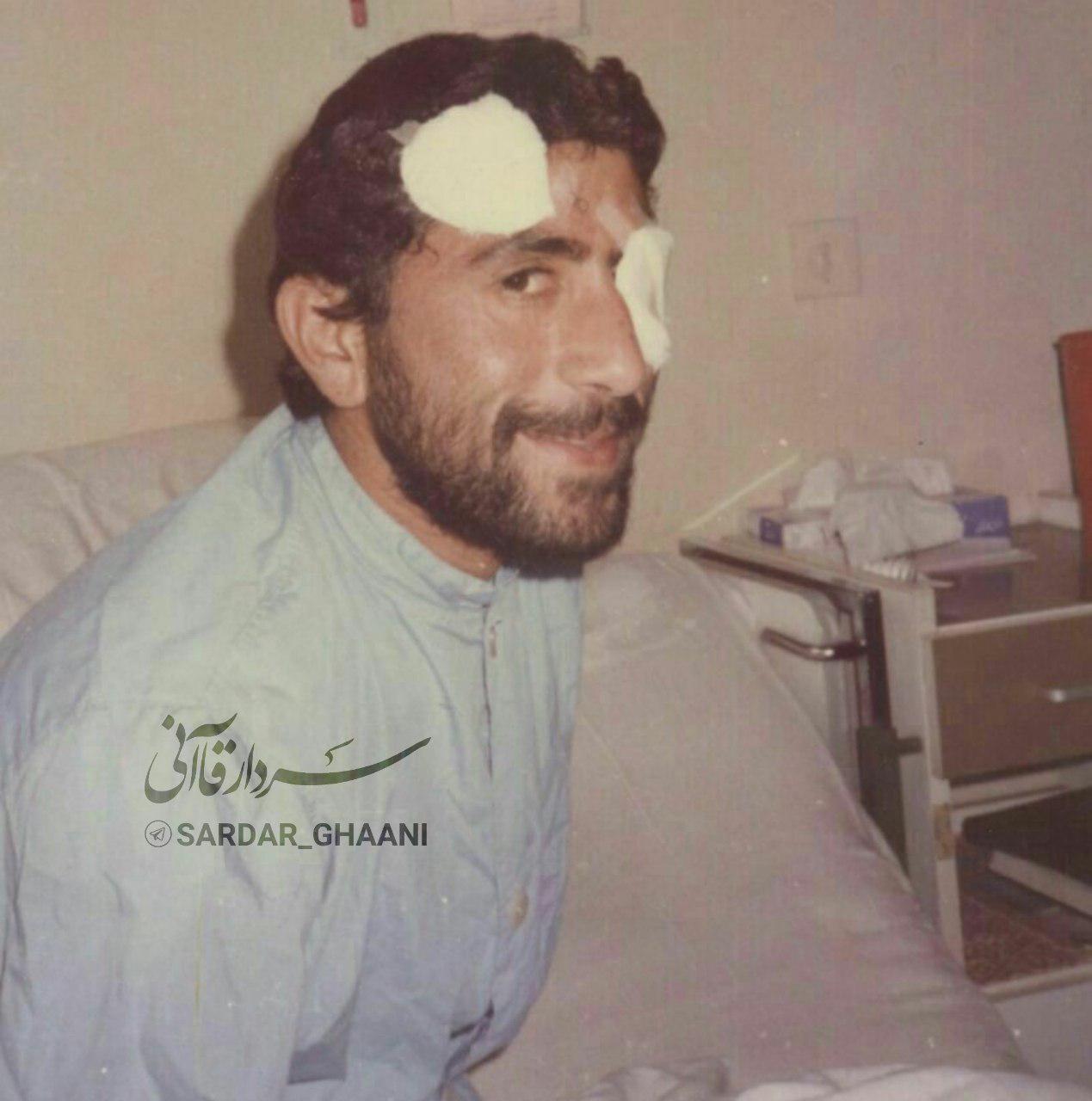 مجروحیت چشم سردار قاآنی در دوران دفاع مقدس