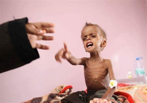 فاسد شدن حجم زیادی از مواد غذایی موجود در انبار‌های سازمان جهانی غذا در یمن + فیلم
