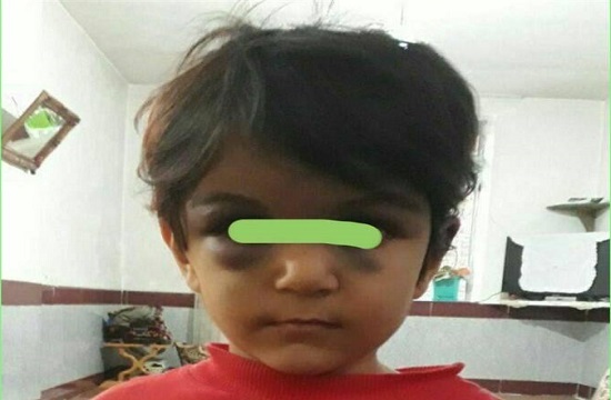 حکم جلب نامادری کودک آزار صادر شد +عکس حکم جلب نامادری کودک آزار صادر شد +عکس