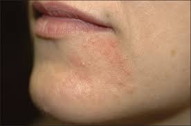 قند خونتان را با گیلاس کنترل کنید/ راهکاری خوشطعم برای کنترل فشار خون/ نکات تغذیهای برای روزه اولیها/ نخوردن سحری جان کبدتان را میگیرد قند خونتان را با گیلاس کنترل کنید/ راهکاری خوشطعم برای کنترل فشار خون/ نکات تغذیهای برای روزه اولیها/ نخوردن سحری جان کبدتان را میگیرد