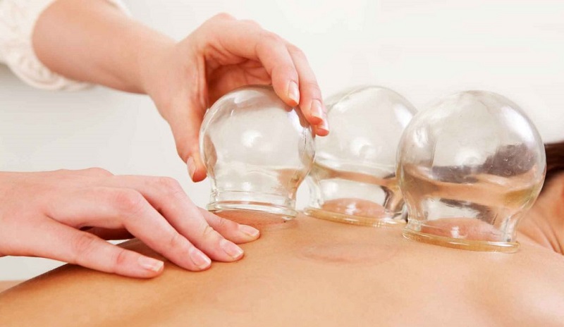 آیا حجامت یک امر آمیخته با مبانی وحی و همراه با معنویت است؟