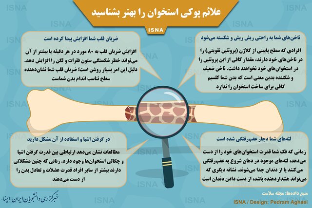 علائم پوکی استخوان را بهتر بشناسید علائم پوکی استخوان را بهتر بشناسید