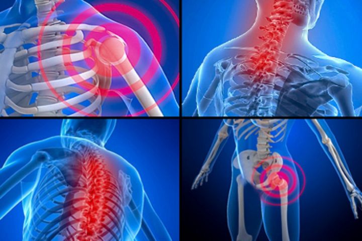 اختلالات اسکلتی عامل افزایش چاقی/ استاندارد ورزش هفتگی برای هر فرد عادی چقدر است؟