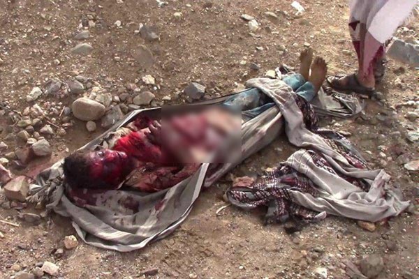 تصاویر دلخراش اجساد تکه&zwnj;شده مردم یمن در حمله ائتلاف متجاوز سعودی