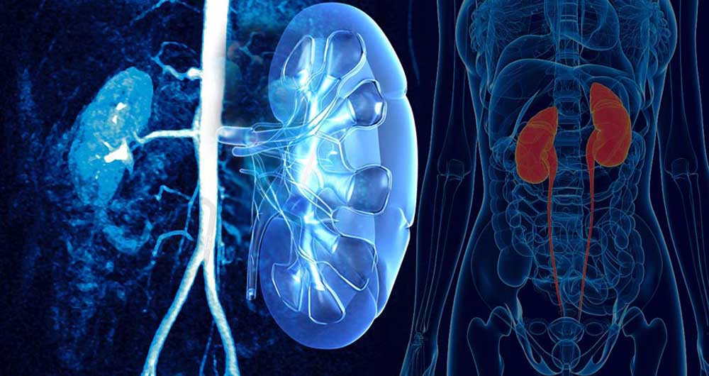 ریفلاکس یا برگشت ادراری؛ از علائم ابتلا تا راهکارهای درمانی