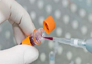 طرح غربالگری اختلالات ژنتیک در کردستان اجرا می شود