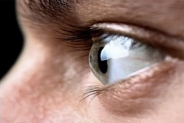 دلایل ایجاد و درمان خشکی چشم را بشناسید/ آیا مشکلات چشمی باعث ایجاد میگرن می&zwnj;شوند؟