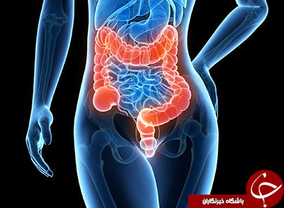 چه مشکلات و بیماری&zwnj;هایی ممکن است برای روده بزرگ یک فرد بوجود آید؟