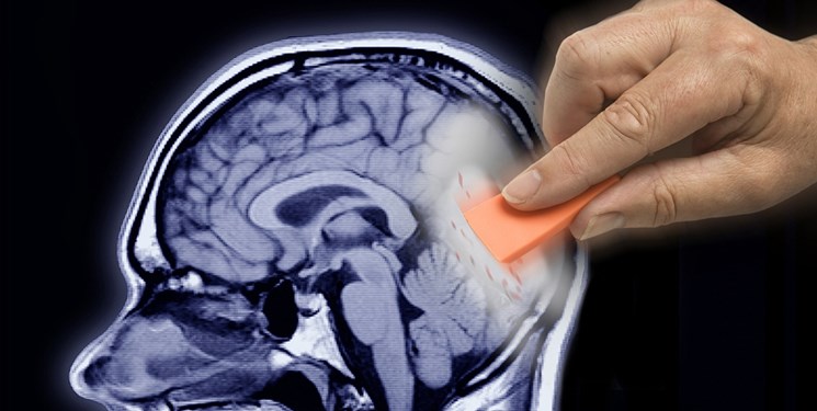 آلزایمر در کمین مبتلایان به کلسترول بالا