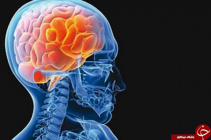 علائم بروز حمله ایسکمیک گذرا را بشناسید تا مانع سکته مغزی و اتفاقات پس آن شوید!