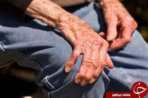 بررسی تغییرات طبیعی در سالمندان