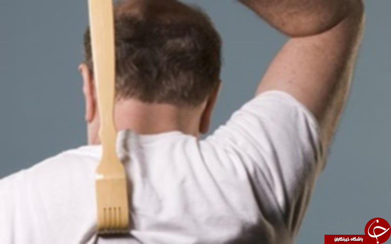 بررسی دلایل لذت بخش بودن خاراندن محل خارش!