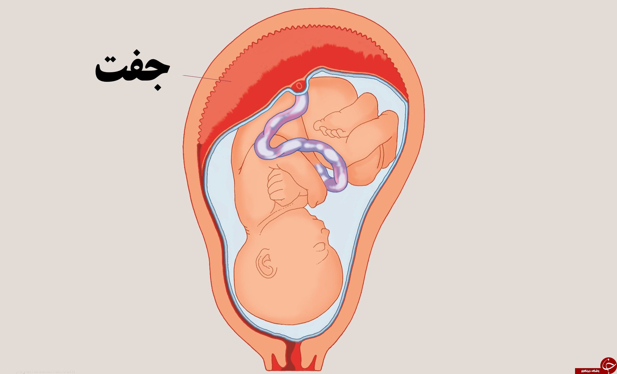 بررسی اثرات نارسایی جفت بر جنین