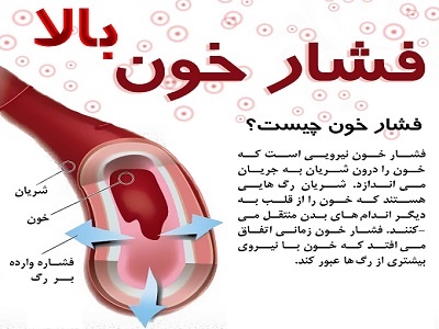 برپایی ۱۱۰ پایگاه سیار کنترل فشار خون در مشهد / ۵۰ درصد مبتلایان به فشار خون از بیماری خود بی اطلاعند