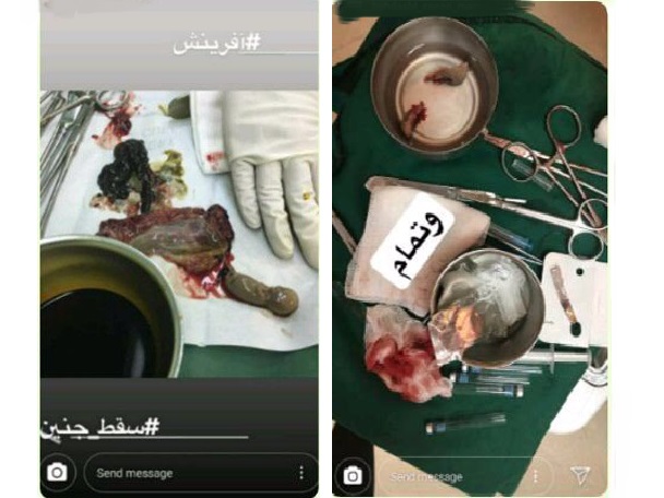 سرانجام تبلیغات مجازی برای سقط جنین/ خاطیان با برخورد جدی مواجه خواهند شد
