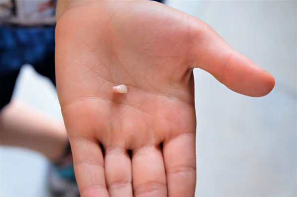 نکاتی بسیار مهم در زمان انجام کمک&zwnj;های اولیه