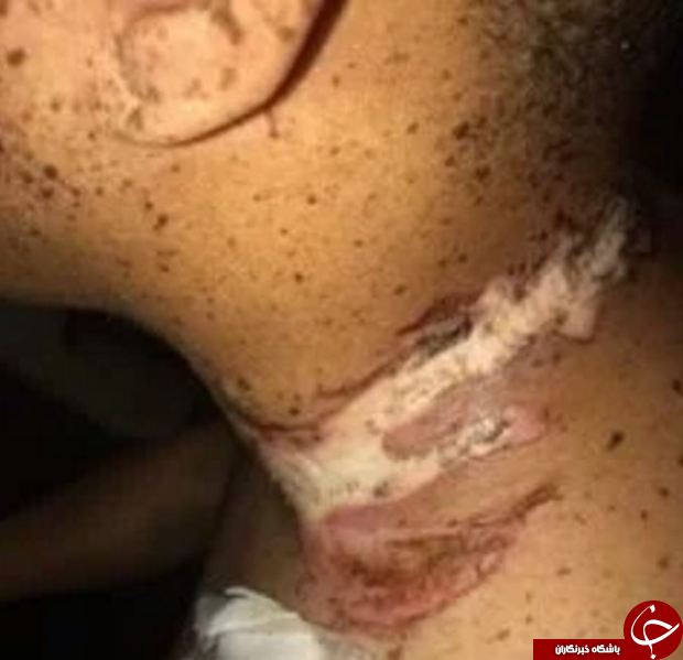 حوادثی که جان آیفون داران را گرفته است +تصاویر