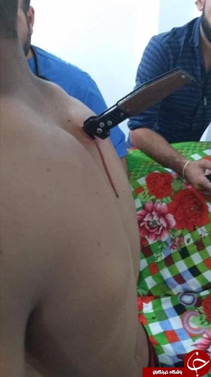 حمله وحشتناک زن داعشی با چاقو به نگهبان سوری + تصاویر