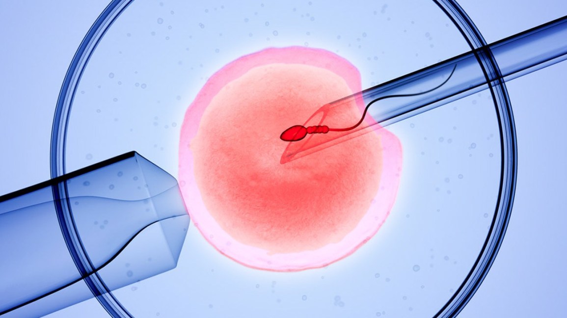 همه آنچه درباره عمل IVF باید بدانید +عوارض احتمالی