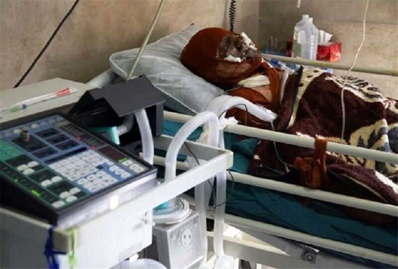۱۲۳ نفر بر اثر سوختگی در سیستان و بلوچستان فوت کردند
