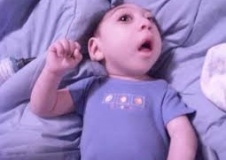 اختلالی که موجب مرگ نوزاد می&zwnj;شود +دلایل ابتلا و روش درمان آنانسفالی