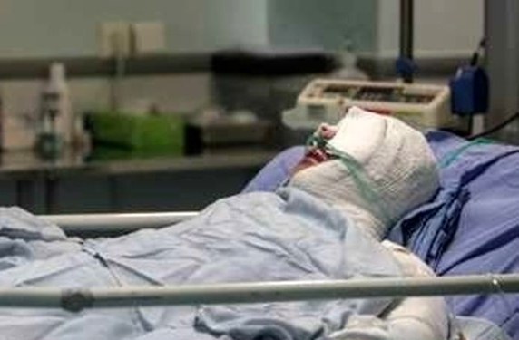 مرگ ۳۲ نفر در اثر سوختگی در آذربایجان شرقی