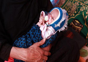 سازمان ملل: در جنگ یمن ۷۵۰۰ کودک کشته یا معلول شده‌اند