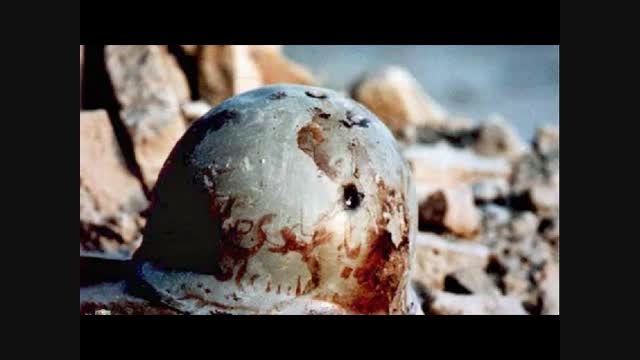 ماجرای شهید زنده‌ای که گلوله مستقیم به پیشانی‌اش خورد ولی زنده ماند! +فیلم