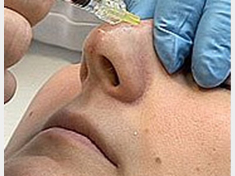 واقعیتی به نام عوارض جراحی