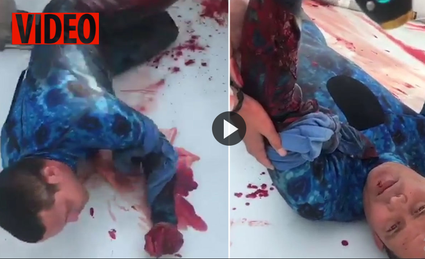 لحظه دلهره آور نجات غواص زخمی پس از حمله مرگبار کوسه ! + فیلم