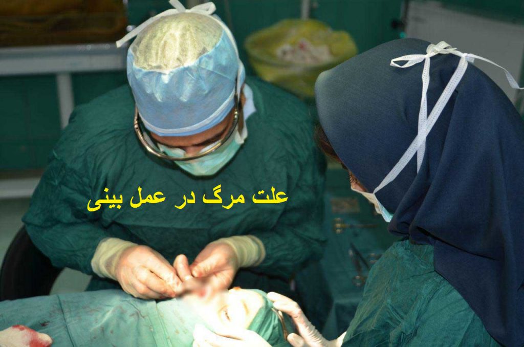 بررسی علت فوت خانم رشتی در کلینیک زیبایی