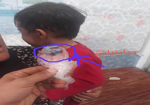 نجات جان کودک یک سال و ۴ ماهه از مرگ حتمی