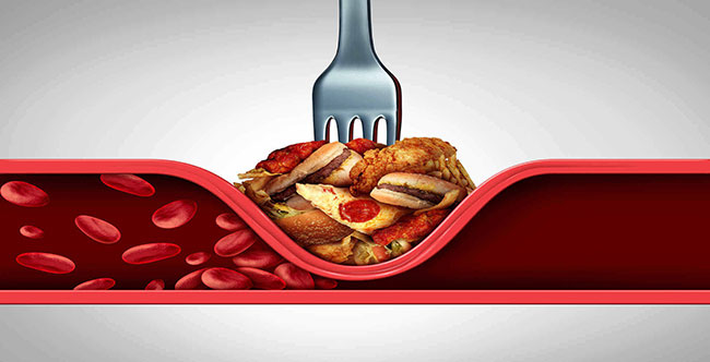 چگونه بفهمیم فشار خونمان بالاست یا پایین؟