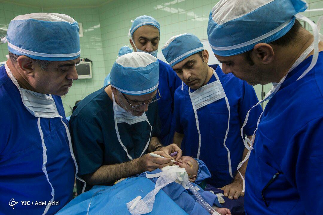 ویزیت و جراحی رایگان شکاف لب و کام در مناطق محروم کشور