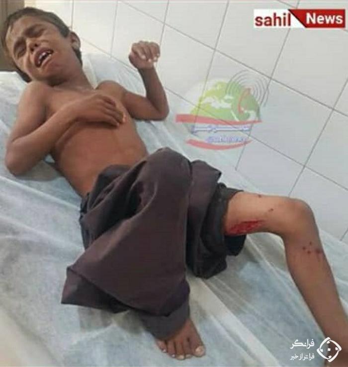 حمله دلخراش تمساح به پسر زاهدانی + عکس