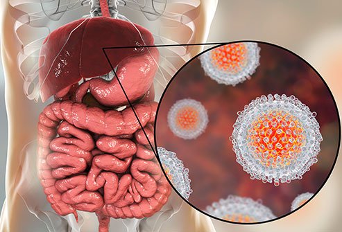 هپاتیت؛ یکی از ۴ بیماری عفونی خطرناک جهان/ معتادان تزریقی ناقلان اصلی هپاتیت c در جامعه