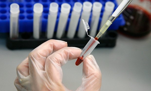 لزوم برگزاری دوره‌های آموزشی پیشگیری از HIV در مدارس