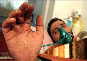 ۲ هزار و ۱۶۳ جانباز شیمیایی در کرمانشاه وجود دارد