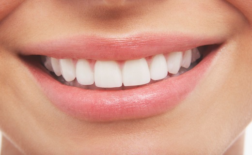 ساعت ۲۱/ لمینت کردن دندانها، نیاز یا زیبایی؟ / طول عمر ونیرهای کاپوزیتی ساعت ۲۱/ لمینت کردن دندانها، نیاز یا زیبایی؟ / طول عمر ونیرهای کاپوزیتی