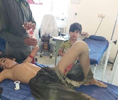 حمله گاندو به نوجوان ۱۳ ساله در شهر پیشین + فیلم