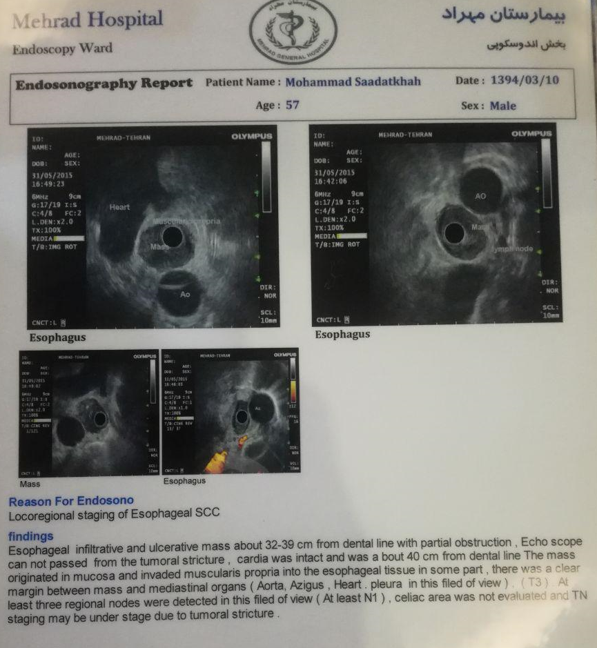 داستان جالب زندگی &laquo;حاج محمد&raquo; که به وقت اضافه کشید