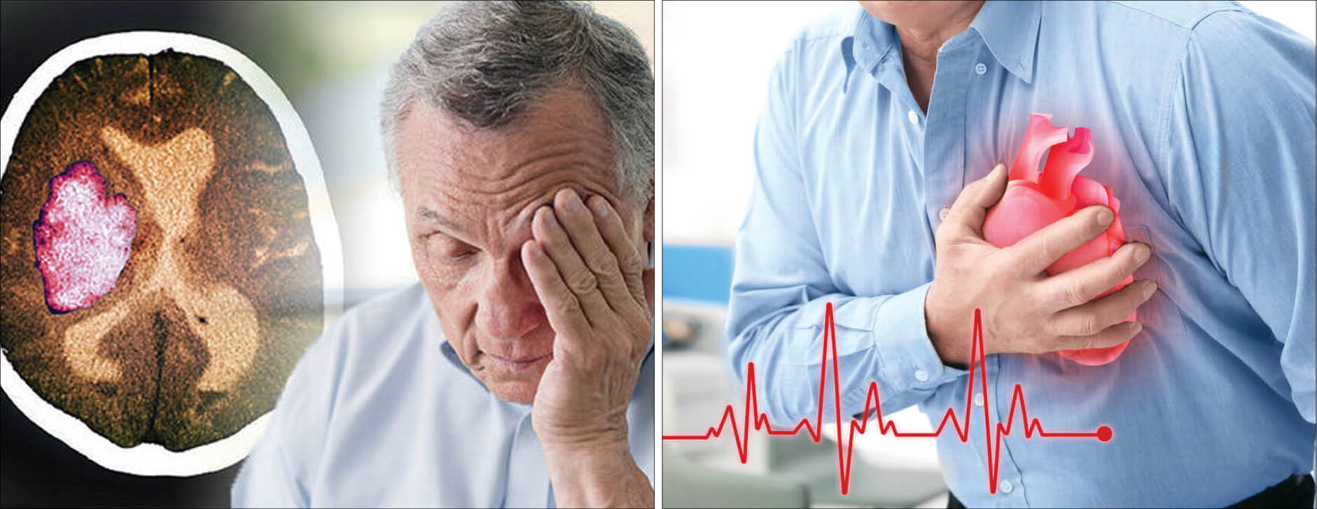 مقایسه علایم و نشانههای سکته قلبی و مغزی مقایسه علایم و نشانههای سکته قلبی و مغزی