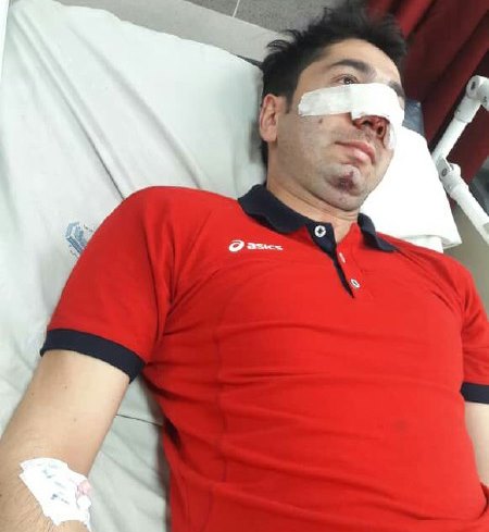 حال آتش نشان مصدوم رو به بهبودی است
